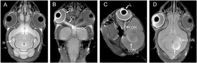 Manganese-Enhanced Magnetic Resonance Imaging: Application in Central Nervous System Diseases
